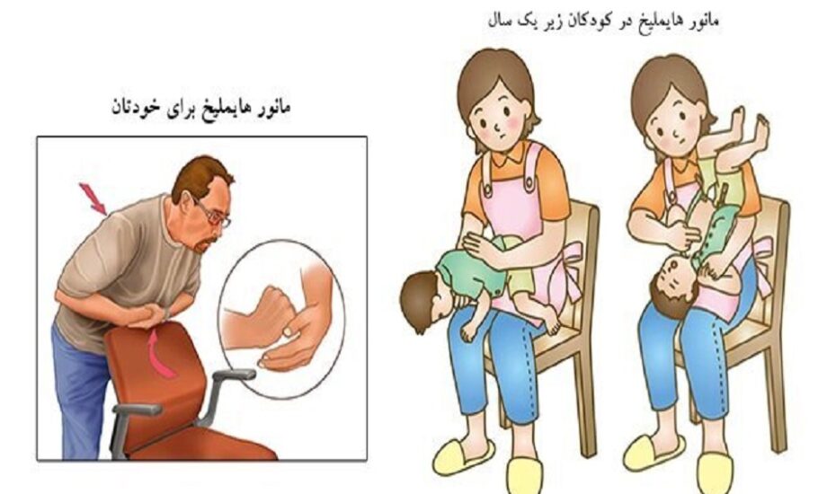 نجات خود از خفگی وقتی تنها هستید