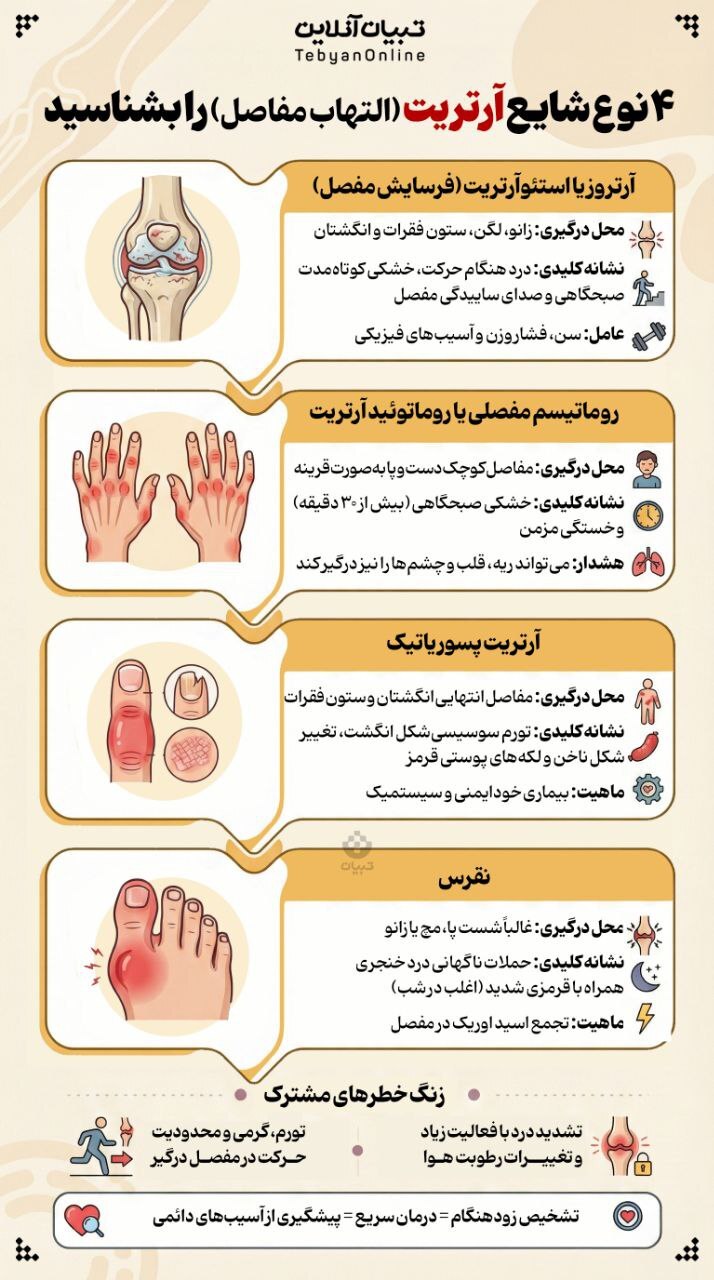 آشنایی با ۴ نوع شایع آرتریت