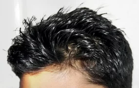 چرا نباید با موی خیس بخوابیم؟ موی+خیس