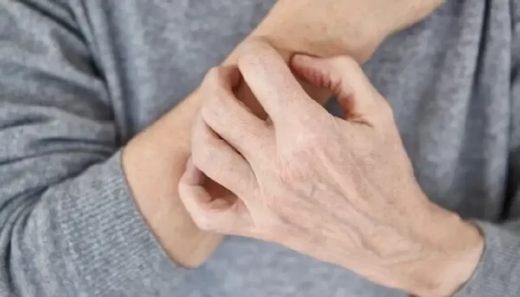 پوست