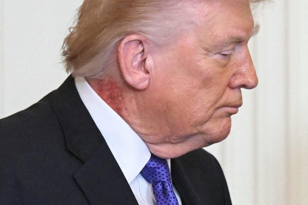 ترامپ