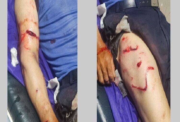 حمله خرس به مرد ۵۸ ساله در ارتفاعات مراغه