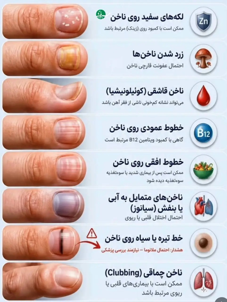 هر لکه و خط روی ناخن یک هشدار است