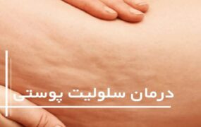 درمان خانگی سلولیت‌ها با ۵ روش ساده و طبیعی