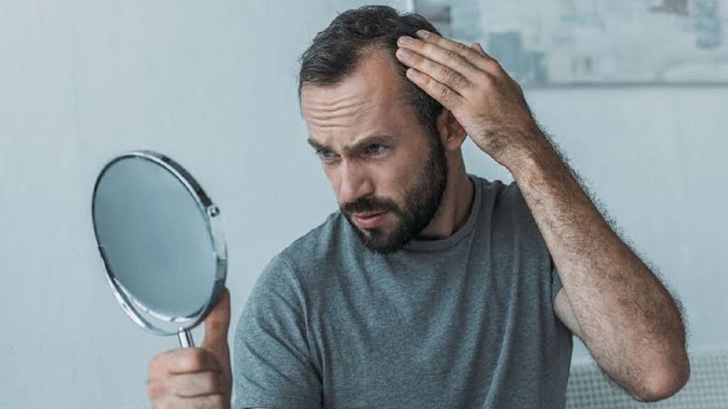 ریزش مو در مصرف‌کنندگان GLP-1 /عارضه جانبی نگران‌کننده داروهای لاغری