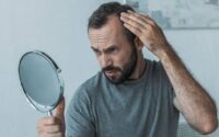 ریزش مو در مصرف‌کنندگان GLP-1 /عارضه جانبی نگران‌کننده داروهای لاغری