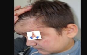 فاجعه در مؤسسه نگهداری اوتیسم