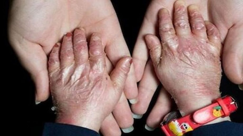 محموله نفت آمریکا بیماران پروانه‌ای