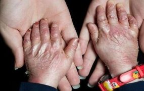 محموله نفت آمریکا بیماران پروانه‌ای
