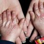 محموله نفت آمریکا بیماران پروانه‌ای
