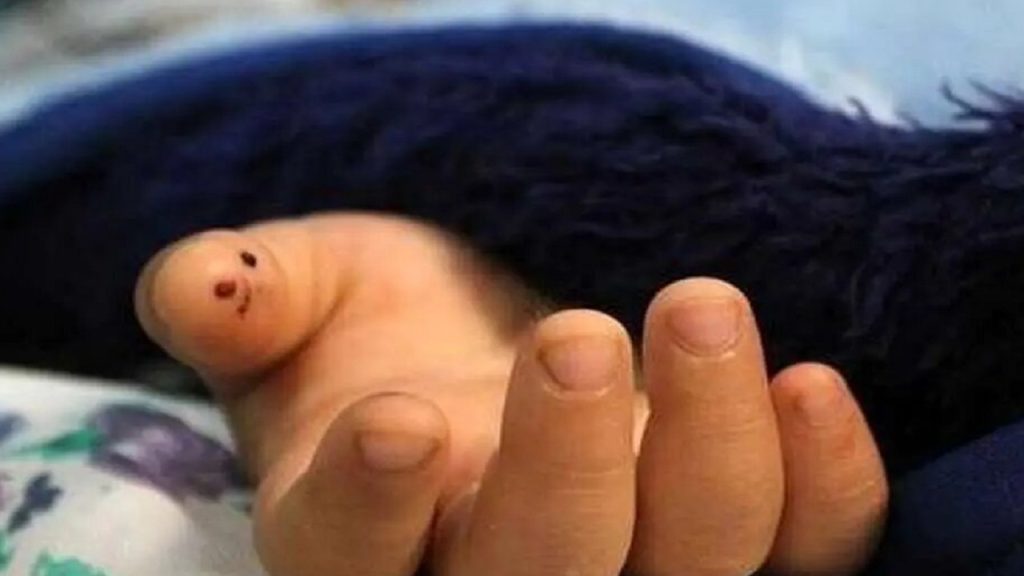 مرگ دختر ۳ ساله بر اثر عقرب‌ گزیدگی