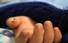 مرگ دختر ۳ ساله بر اثر عقرب‌ گزیدگی